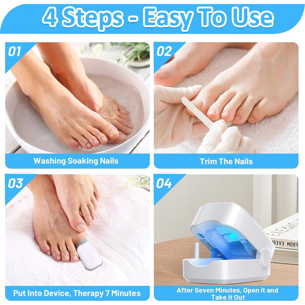 Rechargeable Nail Fungus Laser – Anti-Fungal Device for Toenails, Hands & Feet (Home Use)
