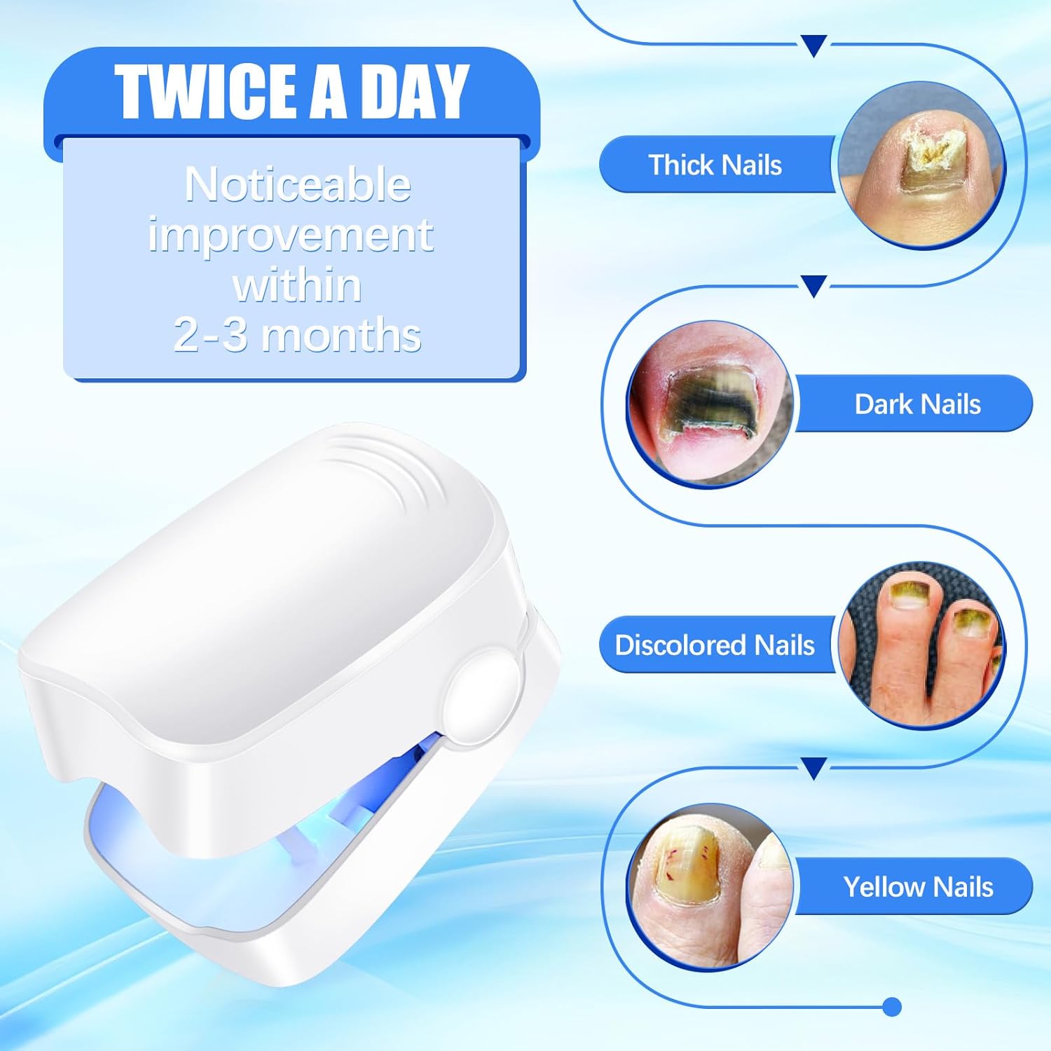 Rechargeable Nail Fungus Laser – Anti-Fungal Device for Toenails, Hands & Feet (Home Use)